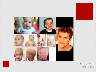 Syndrome de COSTELLO