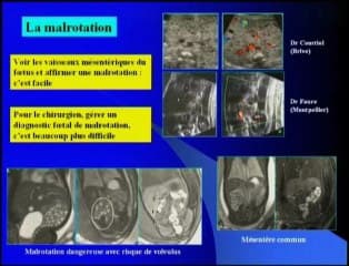 Le tube digestif : synthèse l'imageur