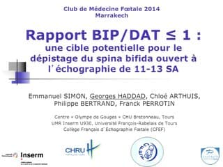 BIP/DAT ratio < 1 à 11-14 SA : signe d'appel en faveur d'un spina bifida aperta