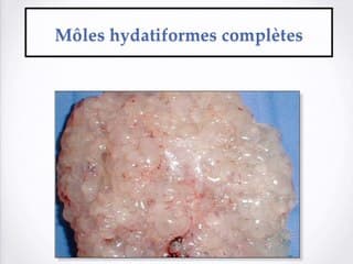 Maladies trophoblastiques,  Imagerie et prise en charge