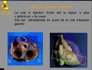 Les gros vaisseaux, les voies d'éjection